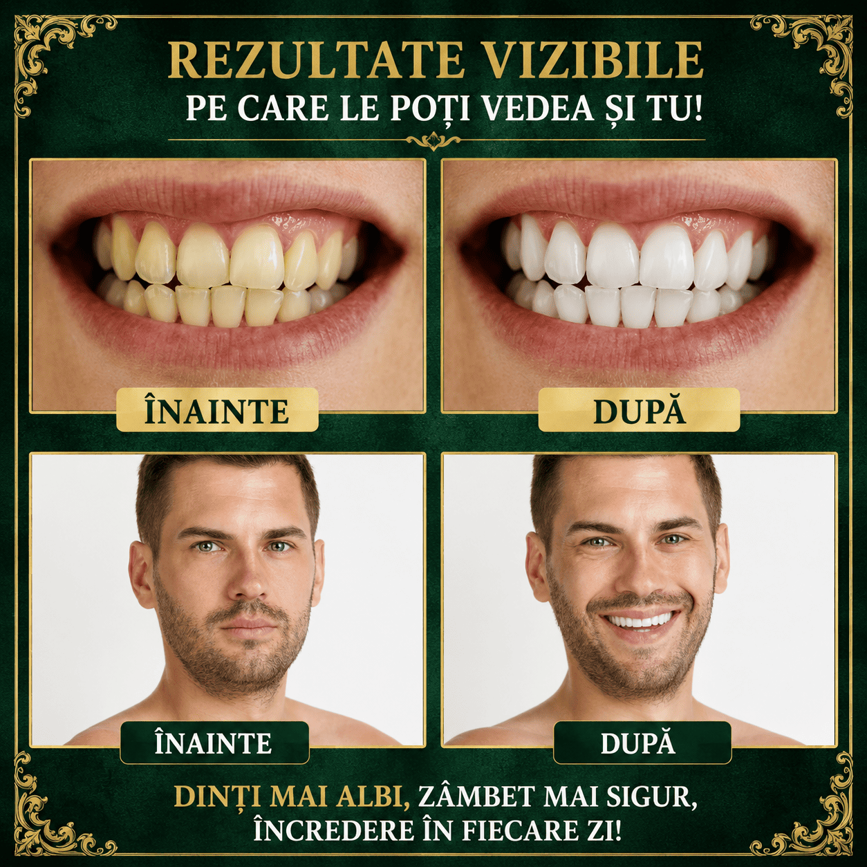 Set 5 Periuțe Naturale Miswak pentru Dinți