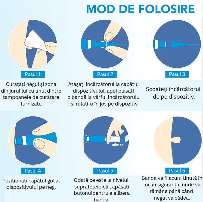 Dispozitiv pentru Îndepărtarea Negilor – Eliminare Fără Durere